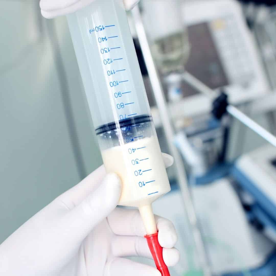 Photo of gloved hand holding bolus syringe with tube feeding formula in it with medical equipment in the background